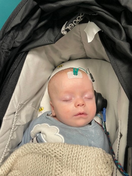Babi yn cysgu yn gorwedd mewn pram, yn gwisgo synwyryddion bach ar y talcen a’r glust wedi’u cysylltu ag offer profi clyw, gan ddangos sut mae prawf clyw baban newydd-anedig yn cael ei gynnal pan fo’r babi’n dawel neu’n cysgu.