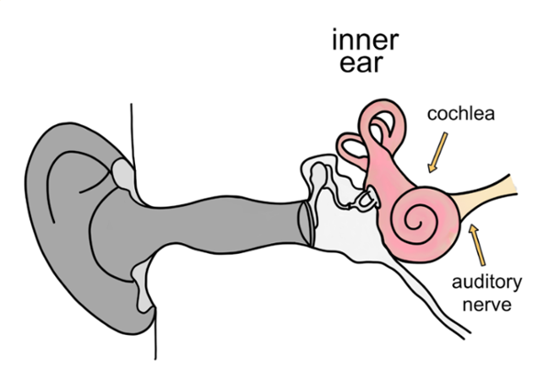 Diagram of the inner ear showing the cochlea and auditory nerve, highlighting the parts commonly associated with sensorineural hearing loss.