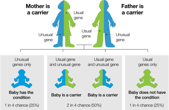 Diagram showing inheritance risk when both parents are beta thalassaemia carriers. The top row shows two adult figures, each half blue and half green, representing carriers with one usual gene and one unusual gene. Below are four possible baby outcomes. The first baby is fully blue, labelled “Baby has the condition – unusual genes only, 1 in 4 chance (25%).” The middle two babies are half blue and half green, labelled “Baby is a carrier – usual gene and unusual gene, 2 in 4 chance (50%).” The final baby is fully green, labelled “Baby does not have the condition – usual genes only, 1 in 4 chance (25%).”